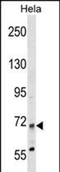 MTMR14 Antibody (N-term)