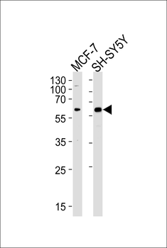 ZBTB22 Antibody (C-term)