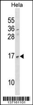 NDUFAB1 Antibody (Center)