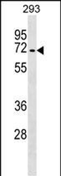 Mouse Tgfbr2 Antibody (C-term)