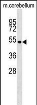 Mouse Stk11 Antibody (C-term)