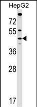 MCAT Antibody (C-term)