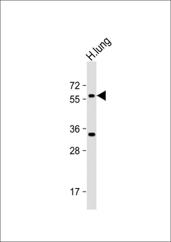 ASB2 Antibody (N-term)