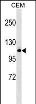 GRIK5 Antibody (N-term)