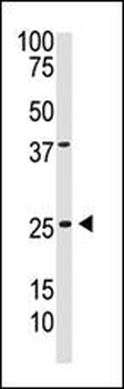 PDGFB Antibody (C-term)