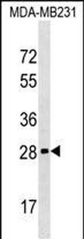 H1FOO Antibody (Center)