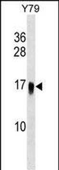 UBE2G1 Antibody (C-term)