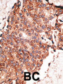 Bmp1 Antibody (C-term)