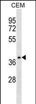 NDRG4 Antibody (Center)