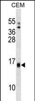 SAA4 Antibody (C-term)