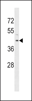 RRM2B Antibody (Center)