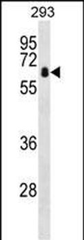 ZBTB7B Antibody (Center)