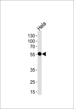 DDX6 Antibody (C-term)