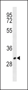 MS4A1 Antibody (C-term)