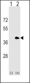 MS4A1 Antibody (C-term)