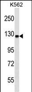 UBA6 Antibody (C-term)