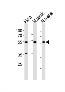 HDAC1 Antibody (Center S423)