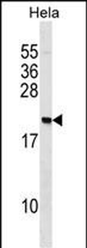 PAIP2 Antibody (N-term)