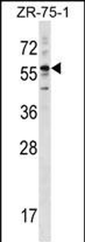 KRT3 Antibody (Center)