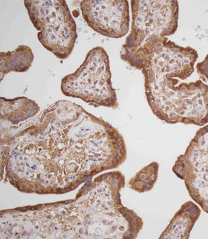 PRL Antibody (Center)