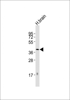 DRD2 Antibody (C-term)