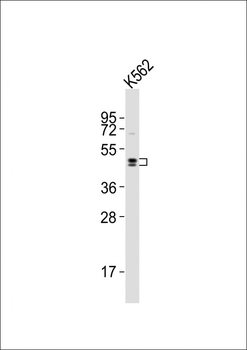 DRD2 Antibody (C-term)