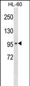 CLCN2 Antibody (N-term)