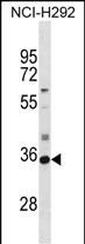 SULT2A1 Antibody (N-term)
