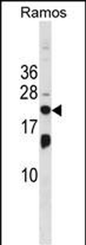 ISG20 Antibody (Center)