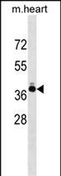 TNNT2 Antibody (Center)