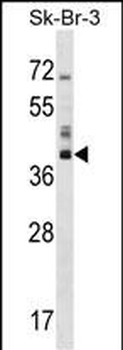 HSD17B1 Antibody (C-term)
