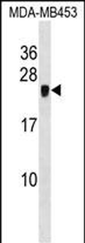 CRIP2 Antibody (C-term)