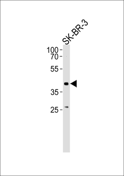 ELK3 Antibody (N-term)