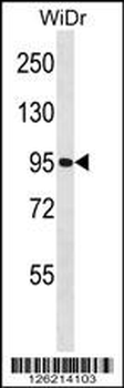 GNL2 Antibody (N-term)