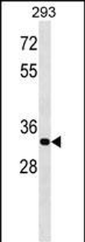 ELOVL4 Antibody (C-term)