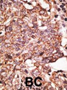 SIGLEC6 Antibody (C-term)