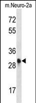 Mouse Cdk1 Antibody (C-term)