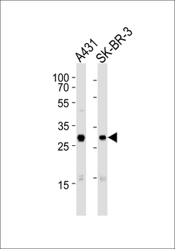 Mouse Cdk1 Antibody (C-term)