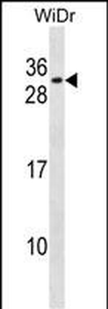 RFXANK Antibody (Center)