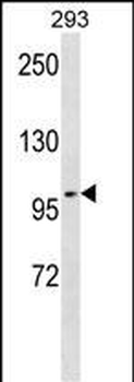 TAX1BP1 Antibody (Center)
