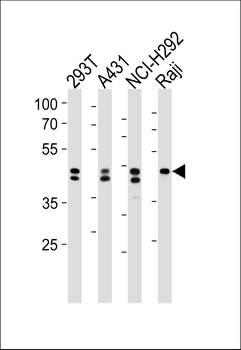 HNRNPD Antibody (N-term)