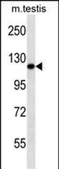 Mouse Ern2 Antibody (C-term)