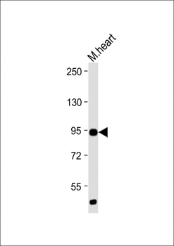 Mouse TLR2 Antibody (C-term)