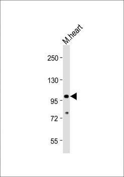Mouse TLR2 Antibody (C-term)