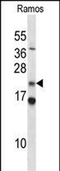 COPS8 Antibody (N-term)