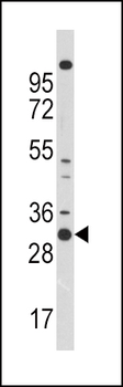 CDC2 Antibody (N-term)