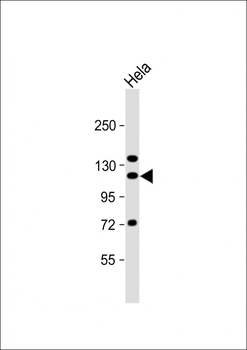 SND1 Antibody (Center)