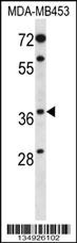 PAQR8 Antibody (C-term)
