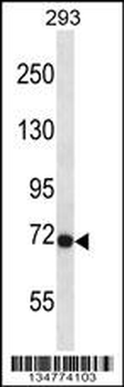 Fgfr3 Antibody (Center)