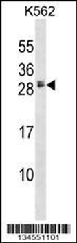 HBEGF Antibody (Center)